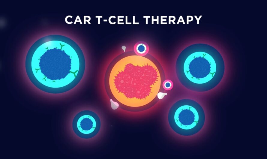 CAR T Cell Therapy Market: Rising Prevalence of Cancer Driving Market Growth