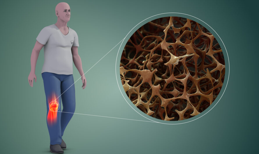 Osteoporosis Treatment Drugs Segment is the largest segment driving the growth of Osteoporosis Treatment Market