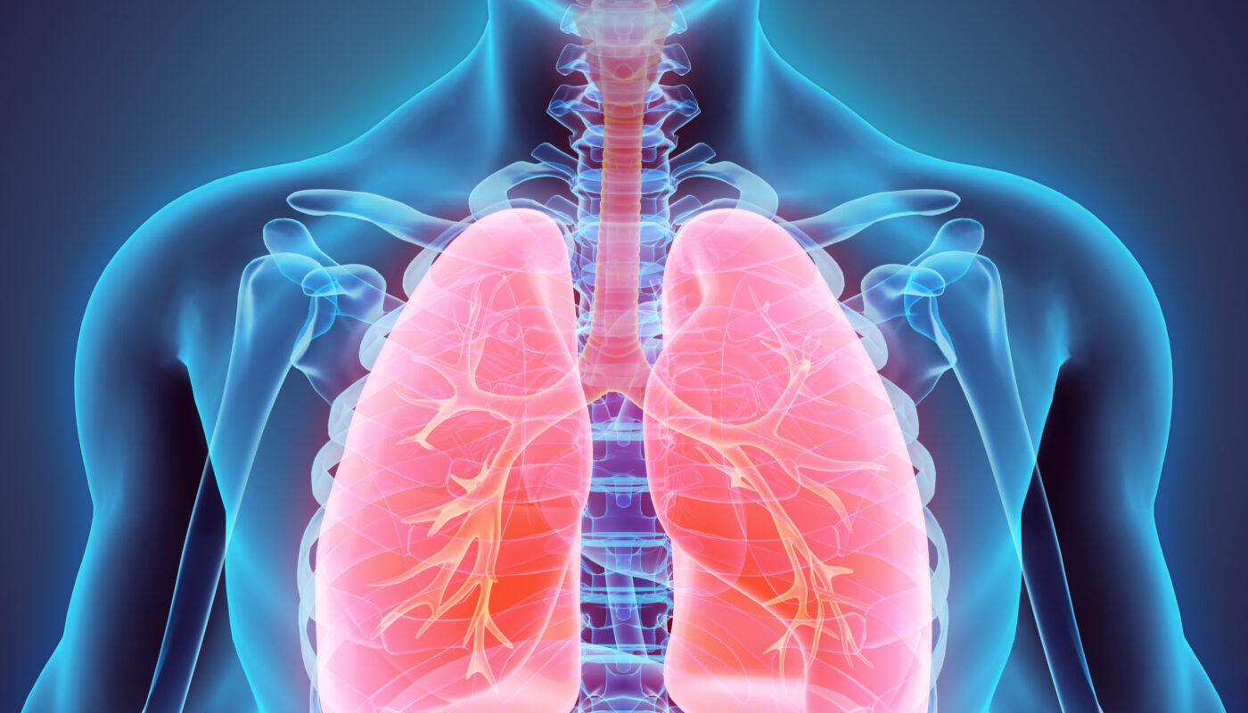 Respiratory Causes