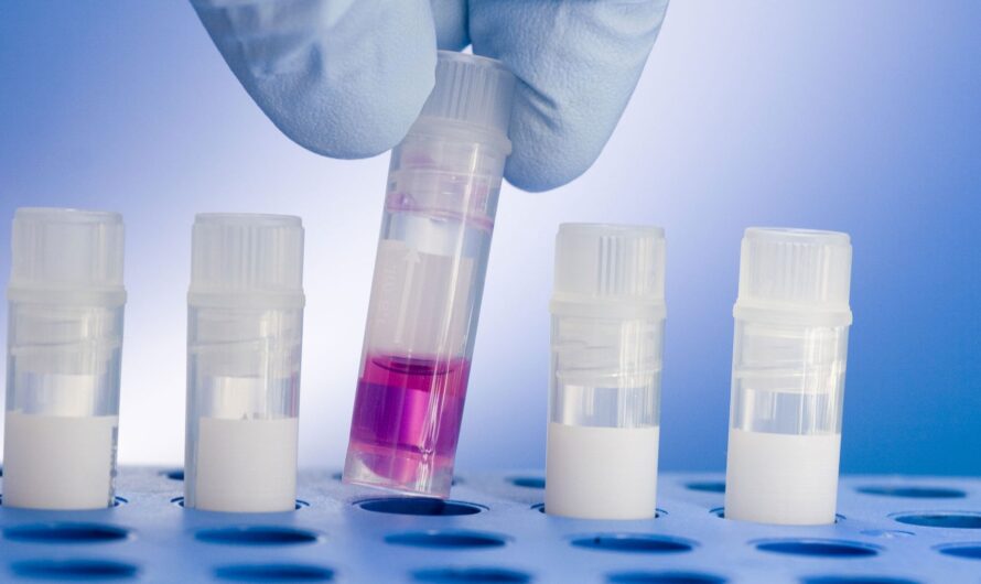 Tissue Banking Market is Expected to be Flourished by Rising Demand for Regenerative Medicine Therapies