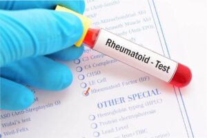 Rheumatoid Arthritis Diagnostic Tests Market

