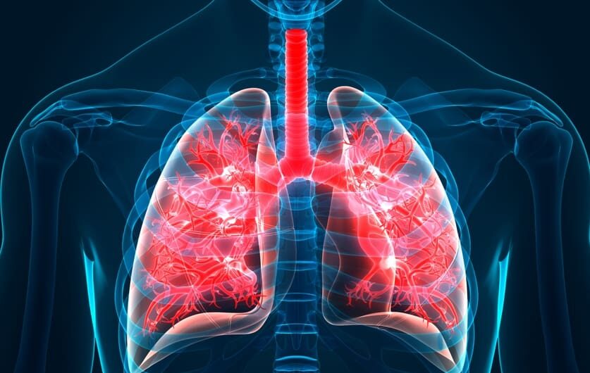 Idiopathic Pulmonary Fibrosis: An In-depth Look into a Devastating Lung Disease