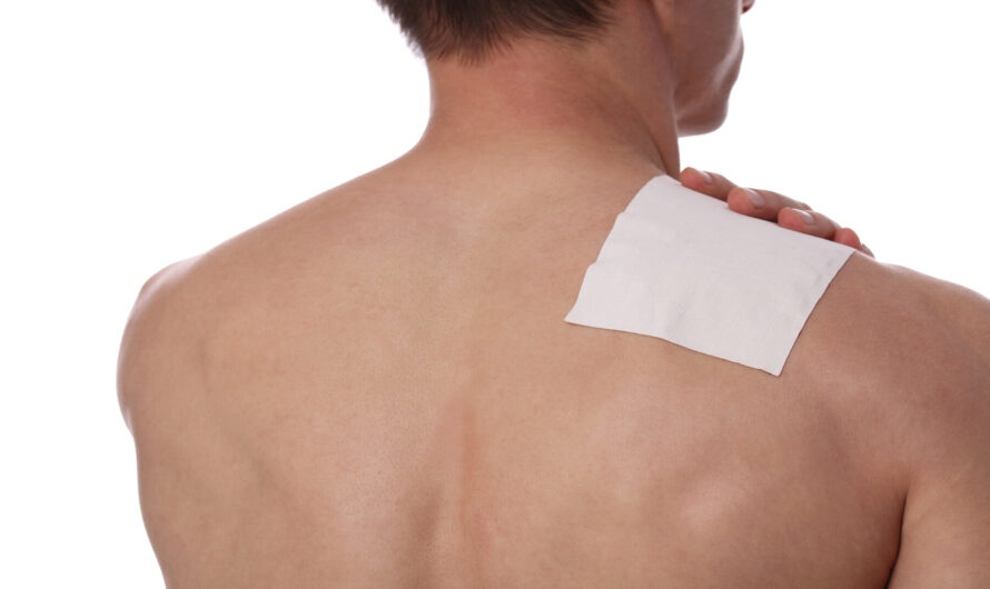 Lidocaine Patches: An Effective Treatment for Neuropathic Pain