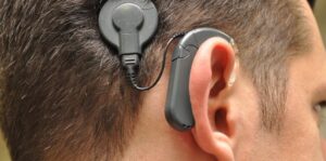Cochlear Implants Market
