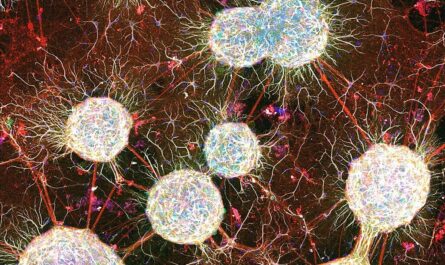 Mimicking Neuroblastoma Vasculature on a Chip: A Breakthrough in Cancer Research