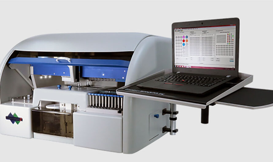 Automated Analyzers Market Owing to Rising Demand for Point of Care Diagnostics