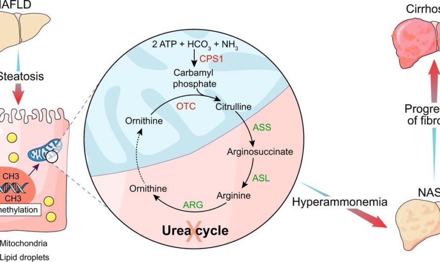 U.S. Urea Cycle Disorders Treatment Market Poised For Steady Growth Owing To Rising Prevalence Of Urea Cycle Disorders